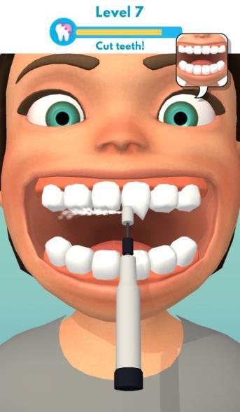 洗牙大师好玩吗 洗牙大师玩法简介