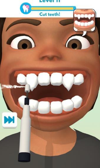 洗牙大师好玩吗 洗牙大师玩法简介