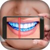 Teeth Germ Scanner Simulator加速器