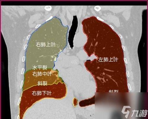 人体工厂（以游戏为主，掌握肺部循环的绝佳方法！）
