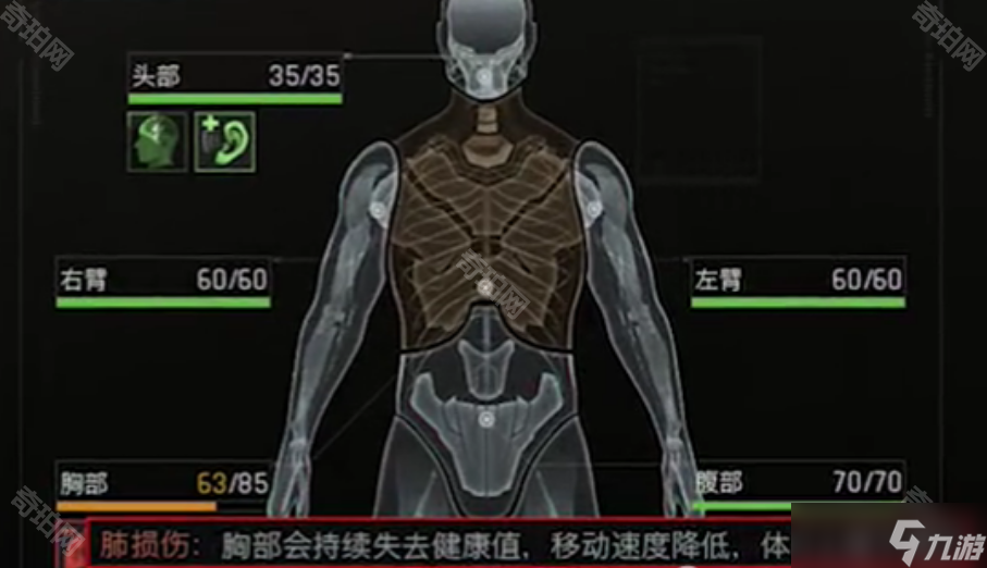 《暗区突围无限》异常状态处理方法