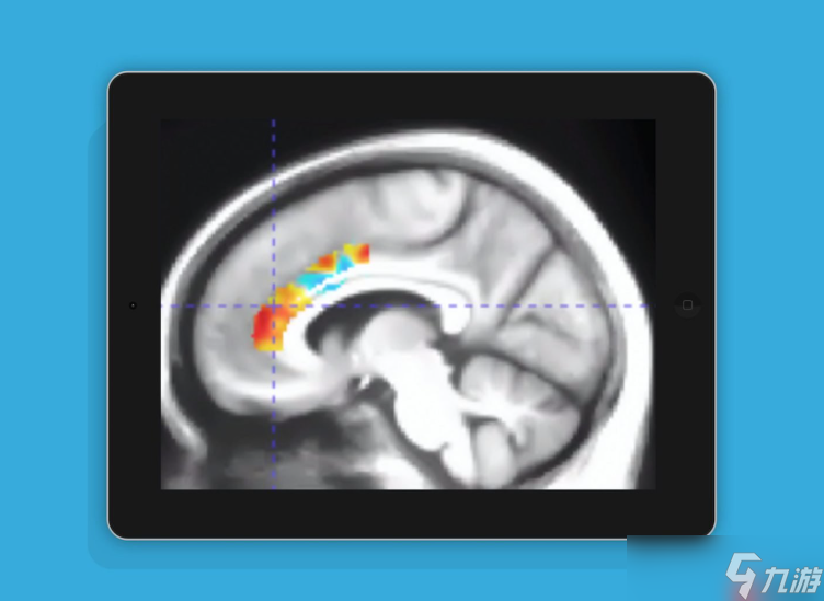 国外新研究 游玩10周大脑训练类游戏可抵消10年脑退化