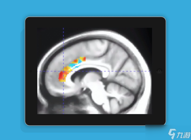 認(rèn)知訓(xùn)練游戲可延緩大腦衰老十年